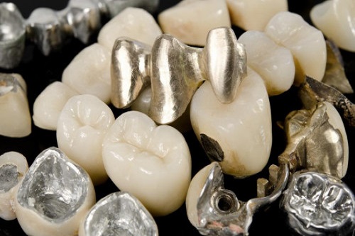 Металлы и их сплавы, используемые стоматологами