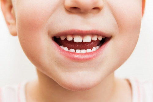 Необходимые меры для подготовки ребёнка к визиту к стоматологу